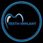 Teeth Implant specialist