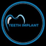 Teeth Implant specialist
