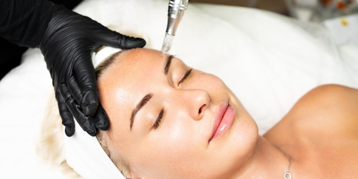Microneedling in Singapore: Skin Renewal with Dermapen & Genius RF at Radium